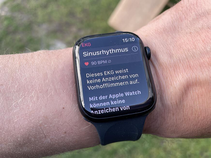 Man sieht, wie auf der Apple Watch 7 ein EKG erstellt wird. 